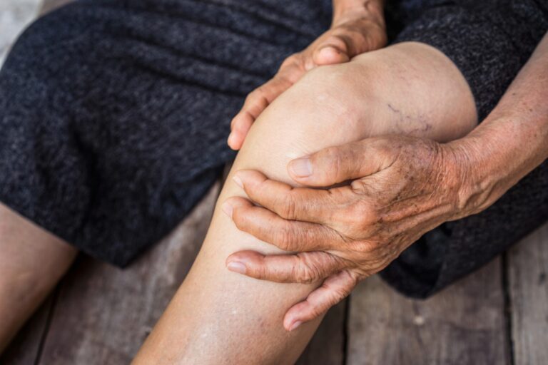 Pension d’invalidité et arthrose : quelles conditions et démarches pour l’obtenir ?
